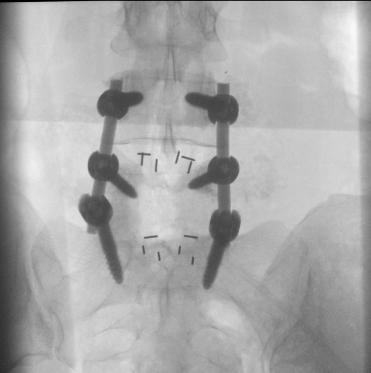 Lino Iracheta Silva-6