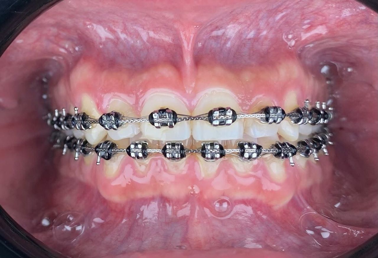 Martha Alicia Ceniceros Betancourt-7