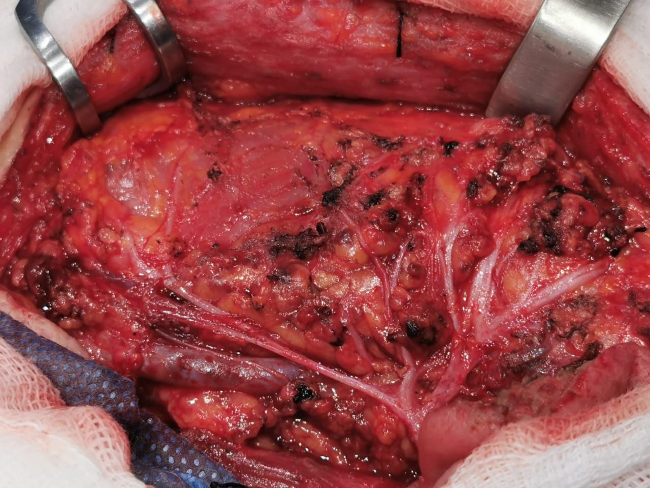 César Espejel Valdés-37