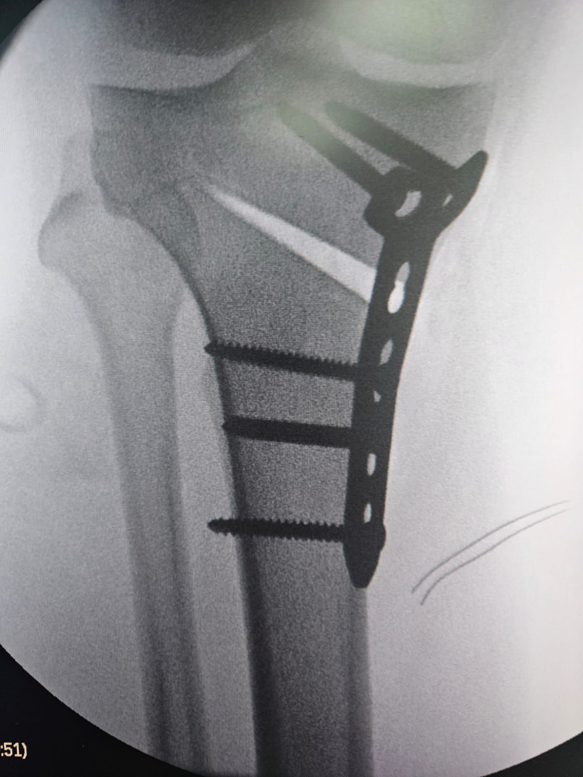 Marcotulio Pérez Valtierra-16