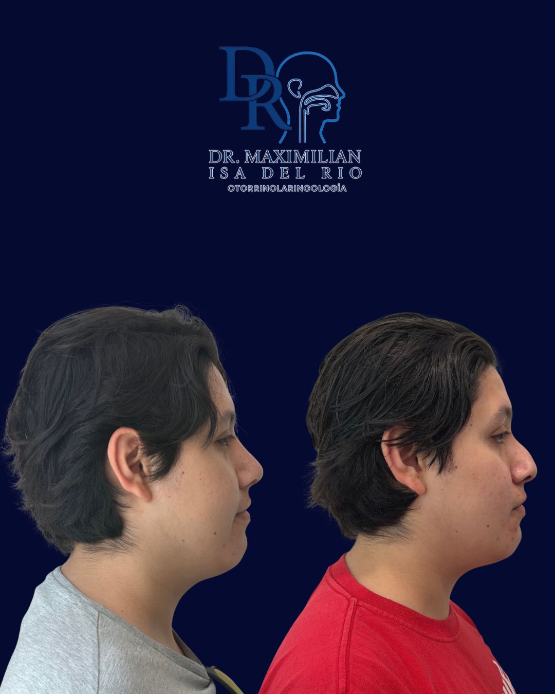 Maximilian Isa Del Rio-1