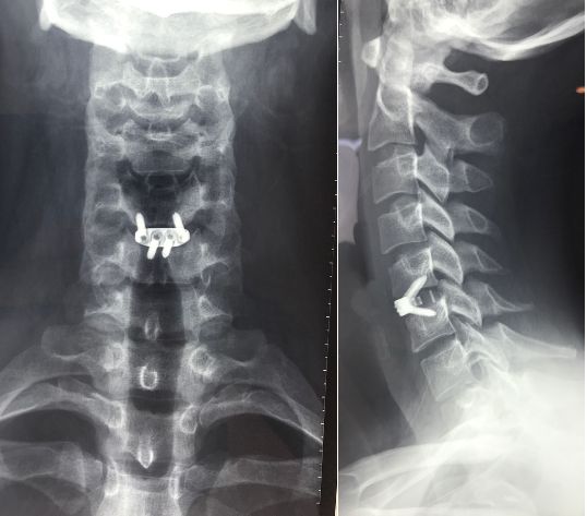 Miguel Adolfo Abdo Toro-0