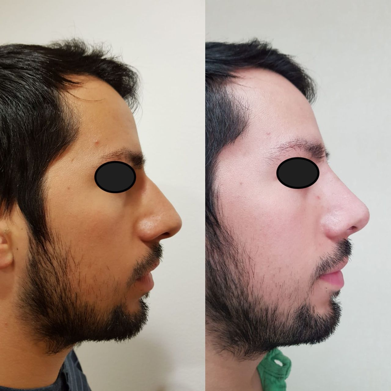 Fernando Nicolas Gonzalez Gonzalez-14