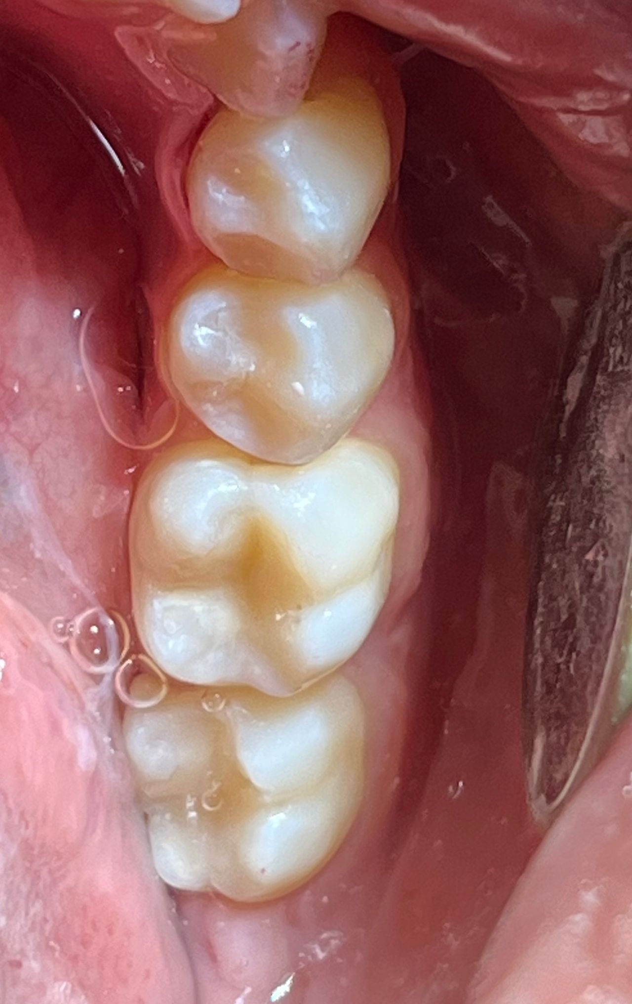 Jennipher Monserrat Salazar Vázquez-6