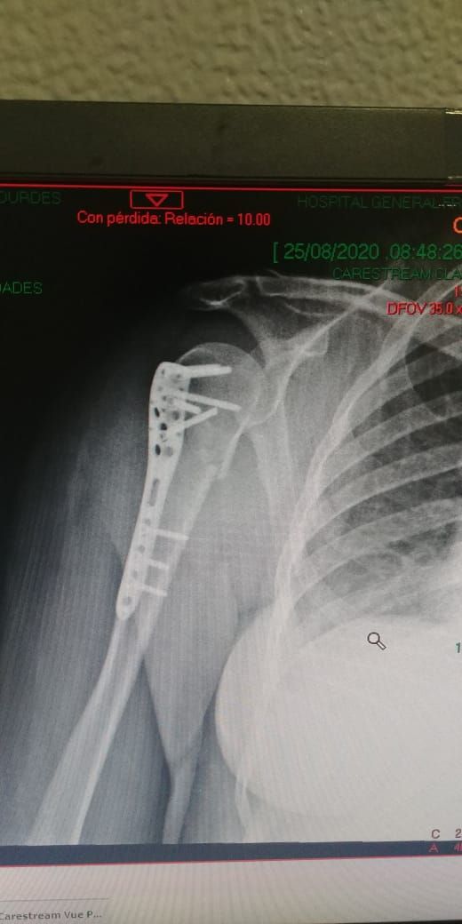 Juan José Luévano De La Cruz-32