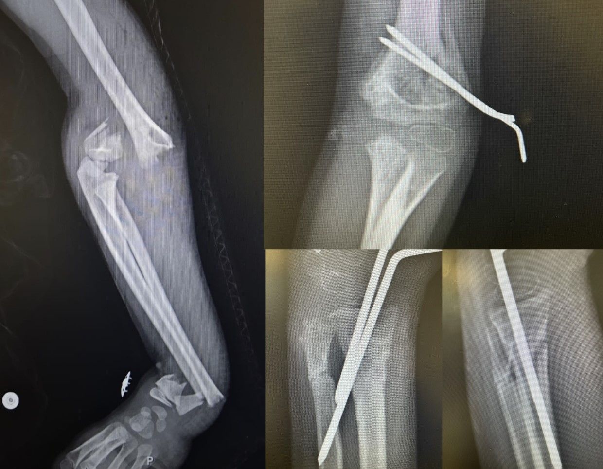 Diego Armando Contreras Rojas-11