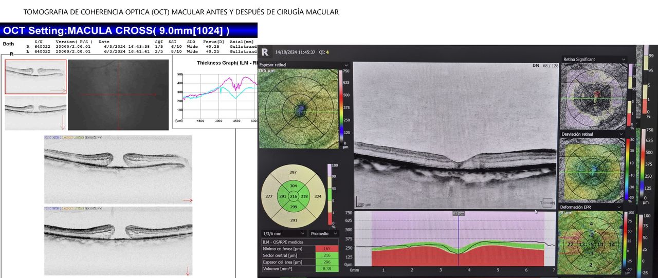 Román Ramírez Marín-0
