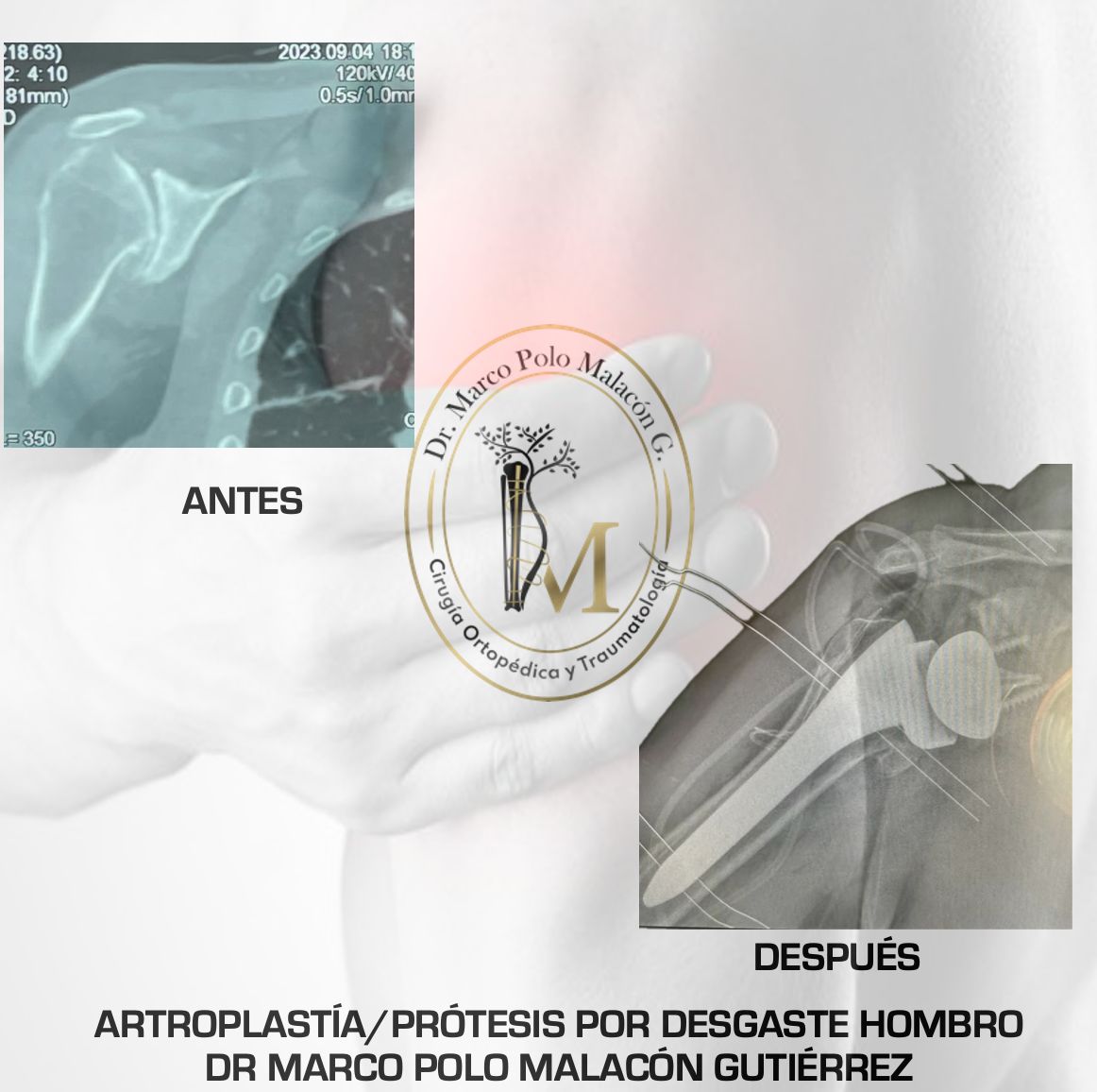 Marco Polo Malacón Gutiérrez-10