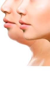 Miguel Ángel Moreno Alba-3