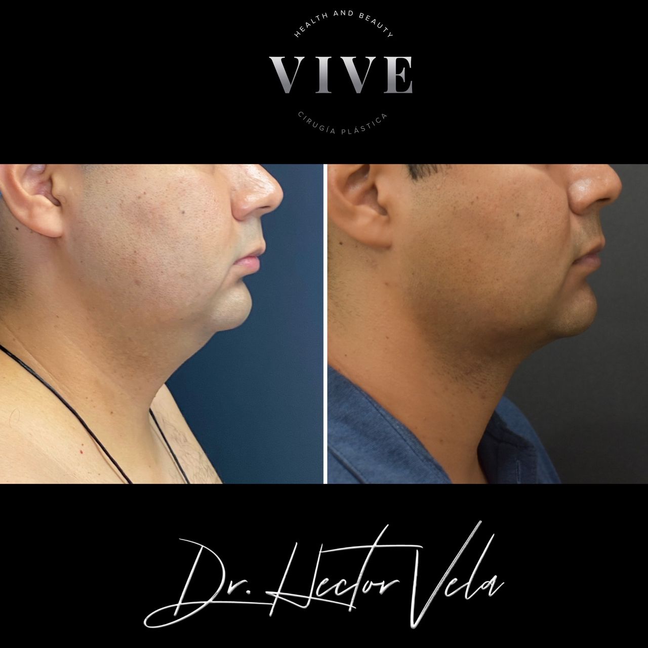 Héctor Eduardo Vela Cardona-195