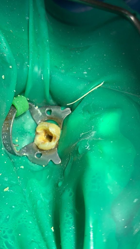 Yuriria Gochy Escalante-10