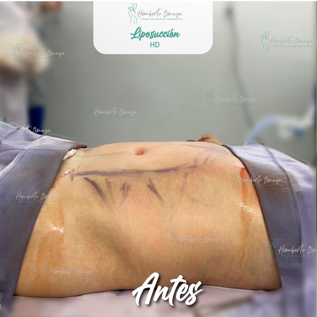 Humberto Osnaya Moreno-15