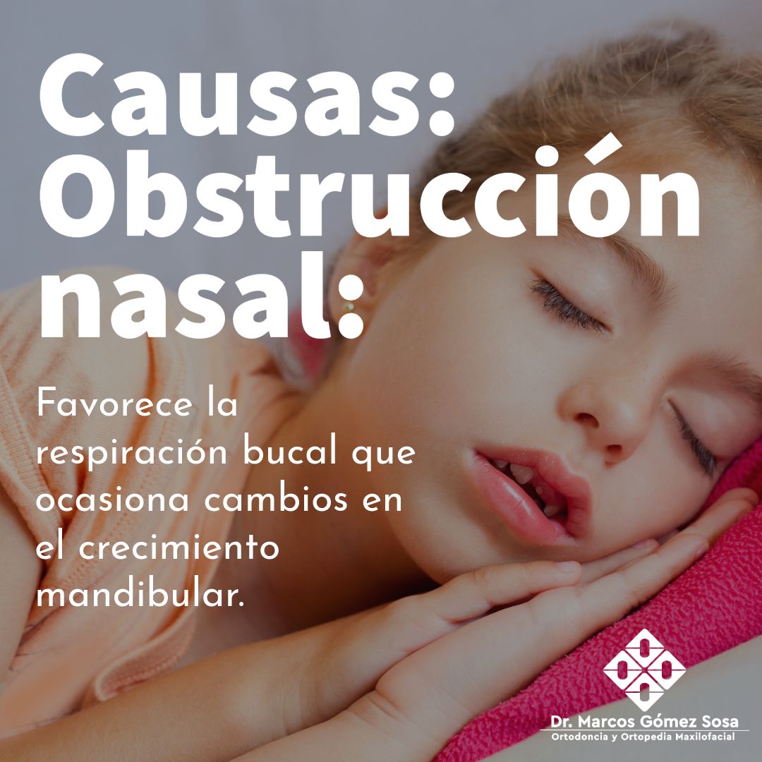 Marcos Gómez Sosa-46