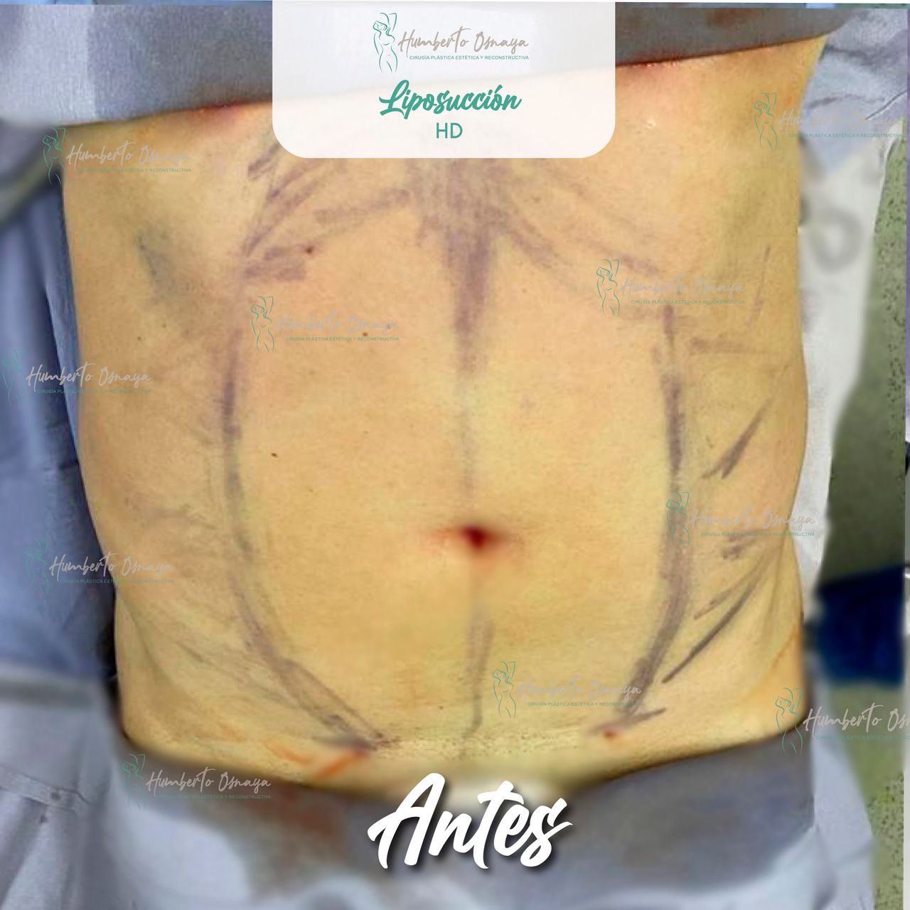 Humberto Osnaya Moreno-17