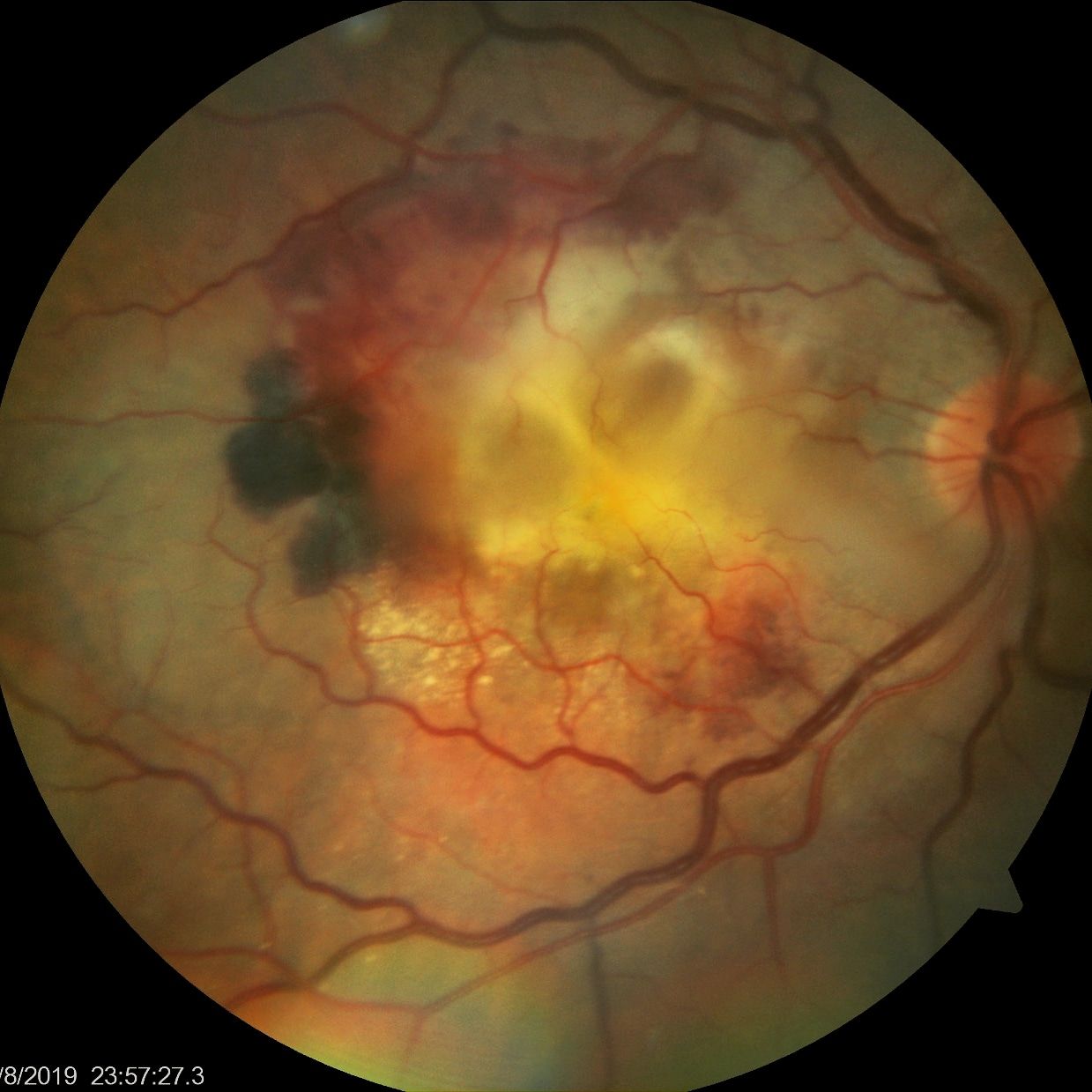 Dalia Méndez Marín-10