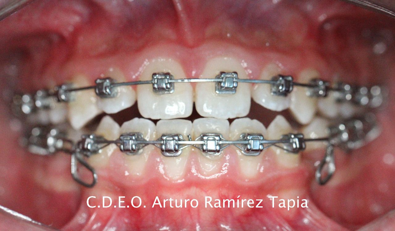 Arturo Ramírez Tapia-7