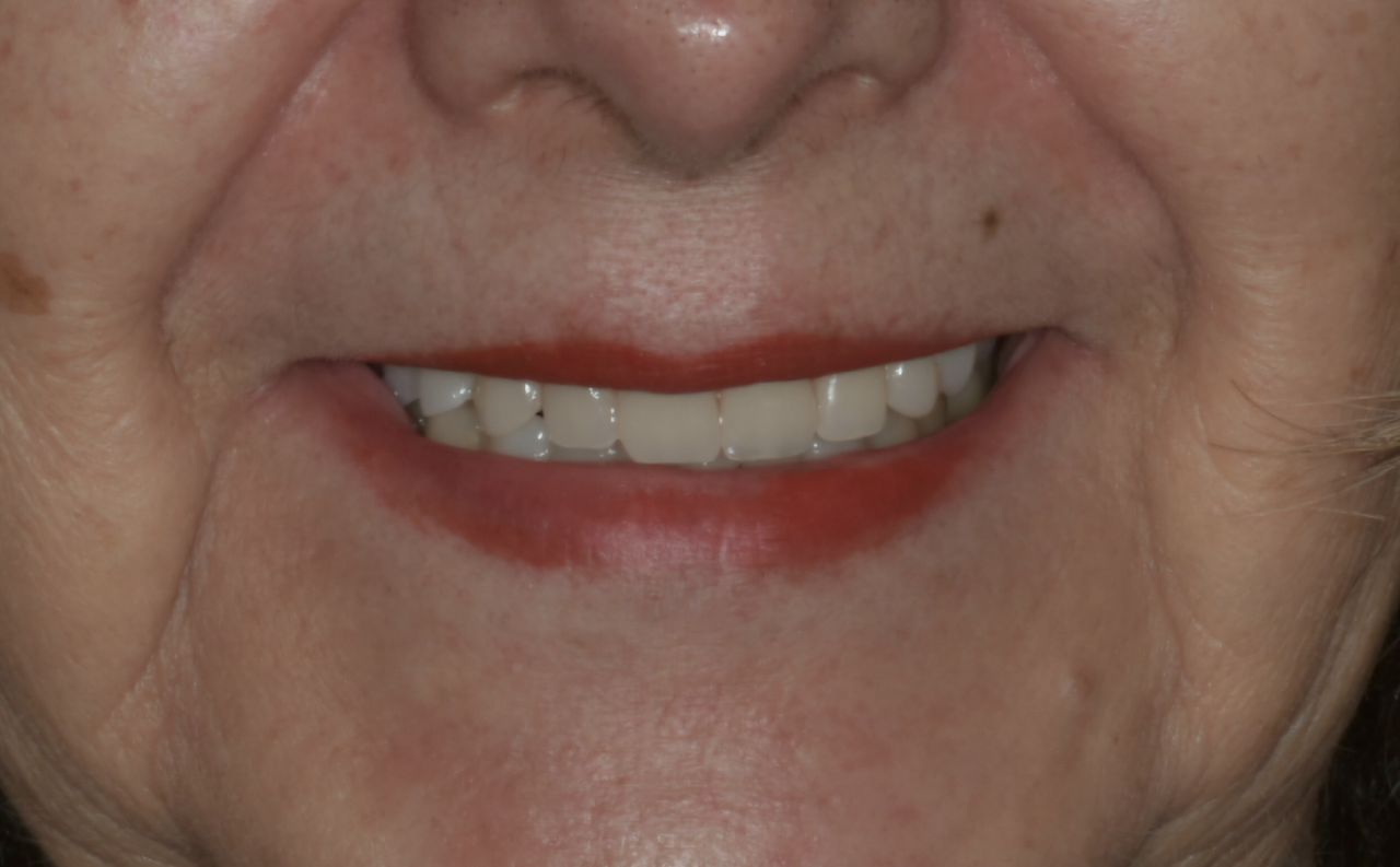 Sebastian Chaustre-3