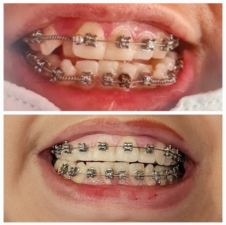 Luis Enrique Trinidad Apanco-0