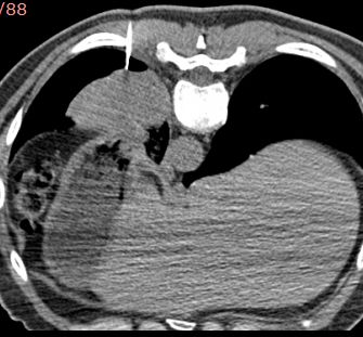 Alejandro Marin Castañeda Baron-13
