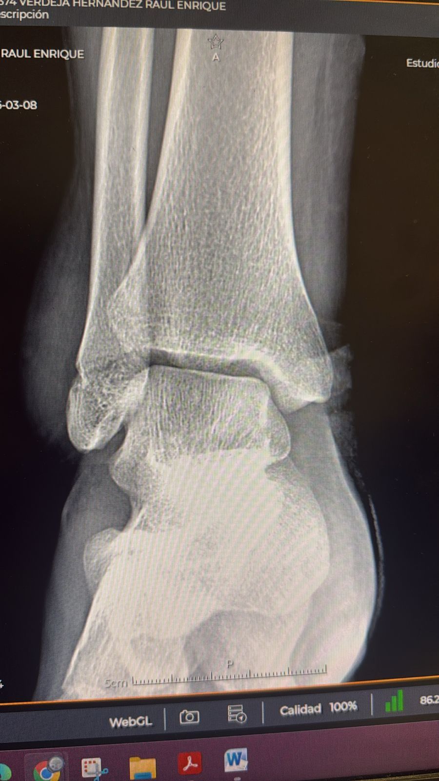 Alejandro Irisson-24