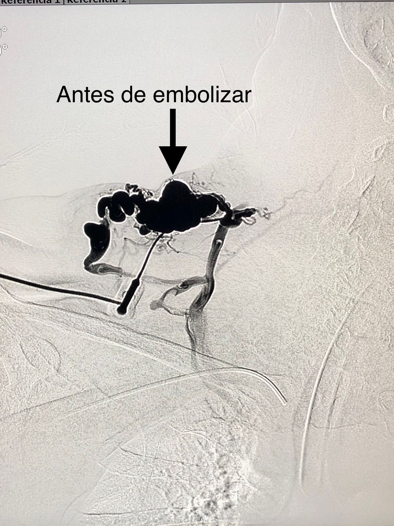 Miguel Abraham Lara Perez-16