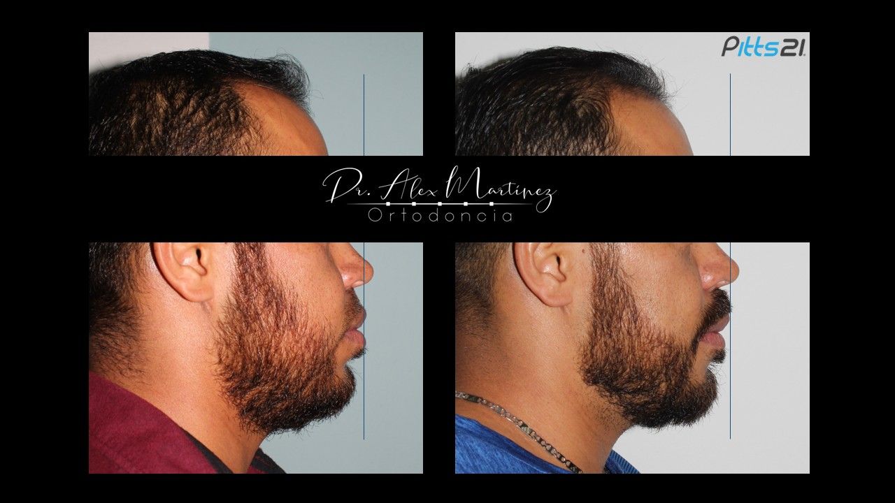 Alejandro Martínez Hernández-9