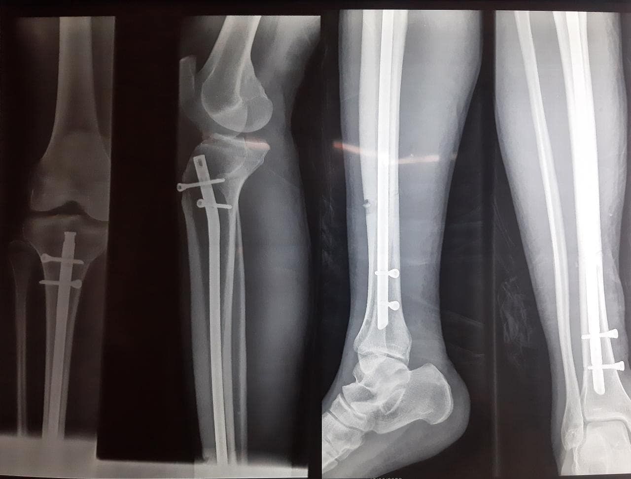 Felix Alfaro Arias-0