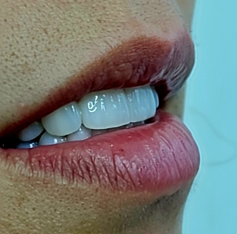 Franco Ferriño Muzquiz-0