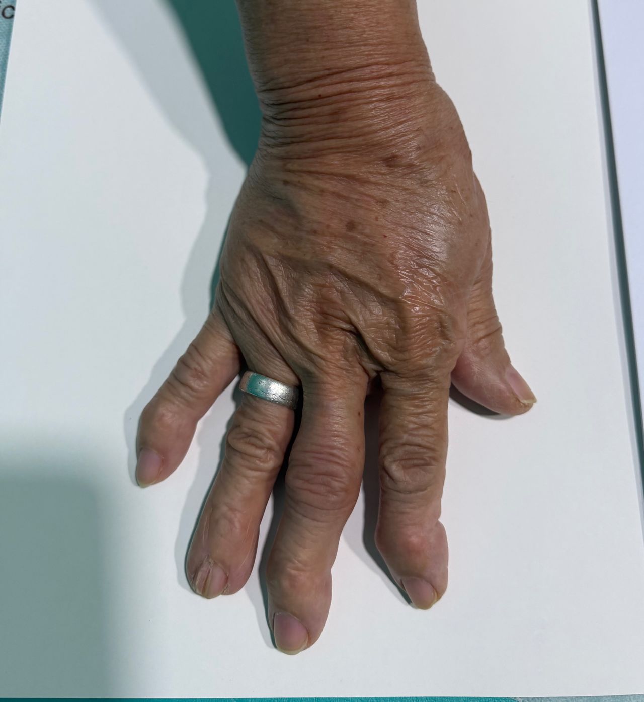 Miguel Angel Serna Reyes-6