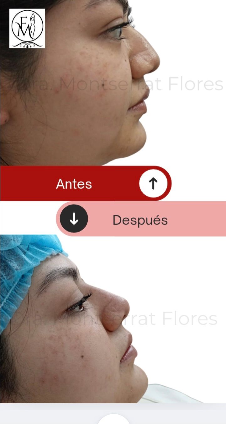 Montserrat Flores Velazquez-22