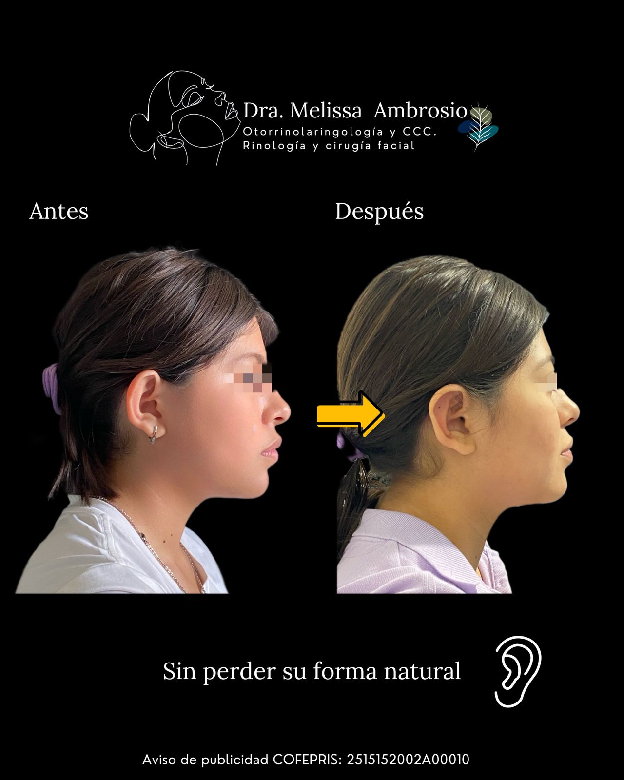 Melissa Guadalupe Ambrosio Mendoza-16