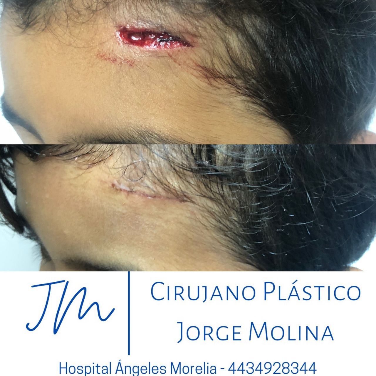 Jorge Eduardo Molina Ortega-10