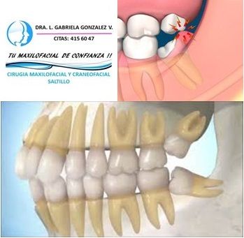 Laura Gabriela González Valdéz-49