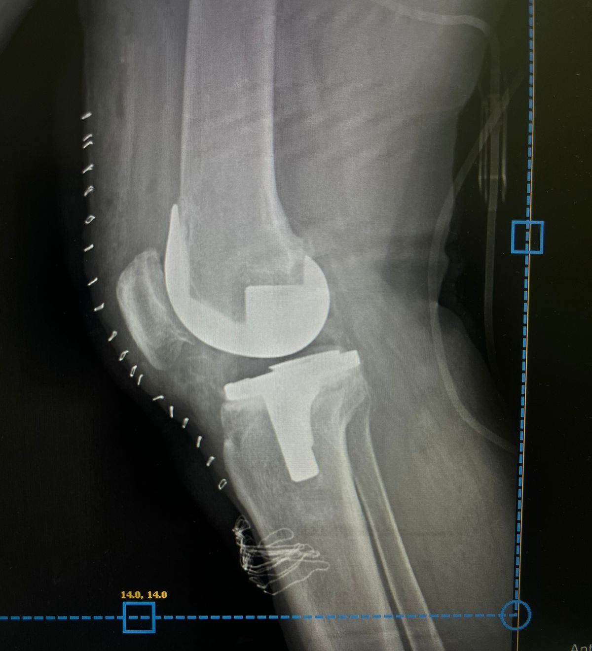 Leonardo Isaac Re-16