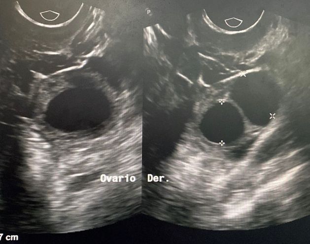 Juan José Solano Perez-10