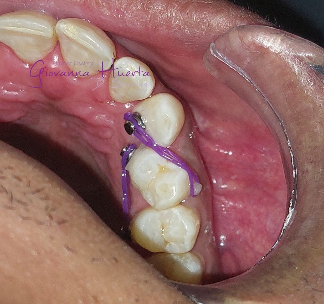 Giovanna Paola Huerta De Santiago-7