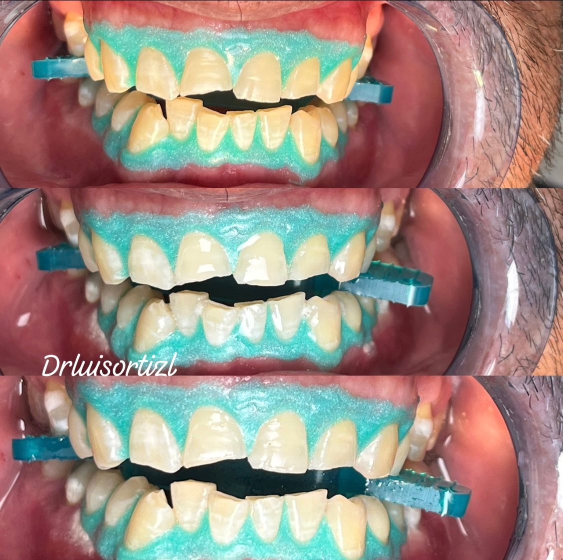 Luis Ángel Ortiz López-16