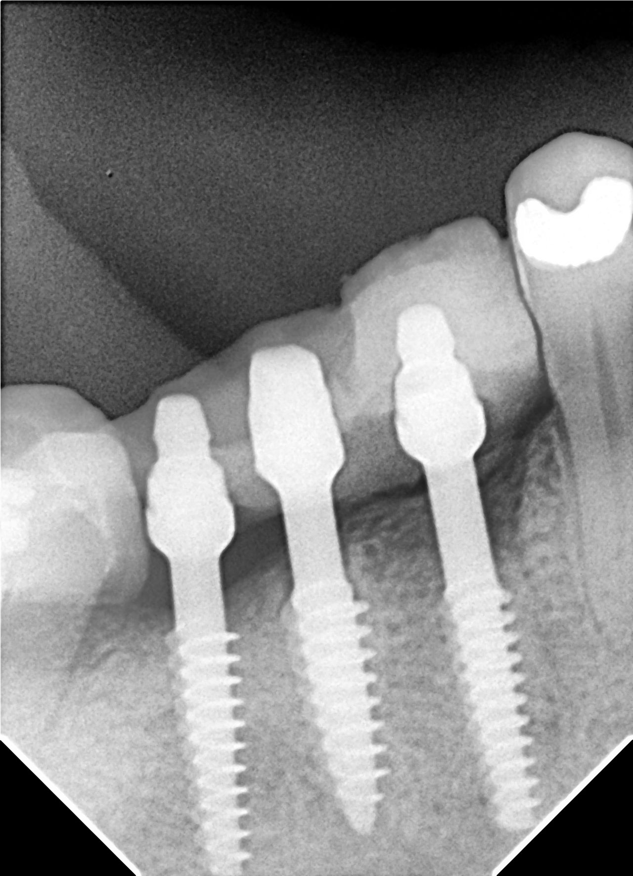 Enrique Sanroman Fitch-2