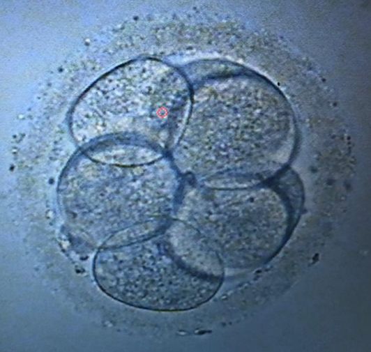 Pablo Joaquín Cervantes Mondragón-6