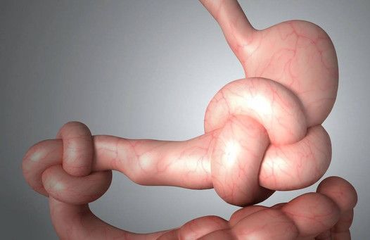 Miguel Angel Rico Hinojosa-13