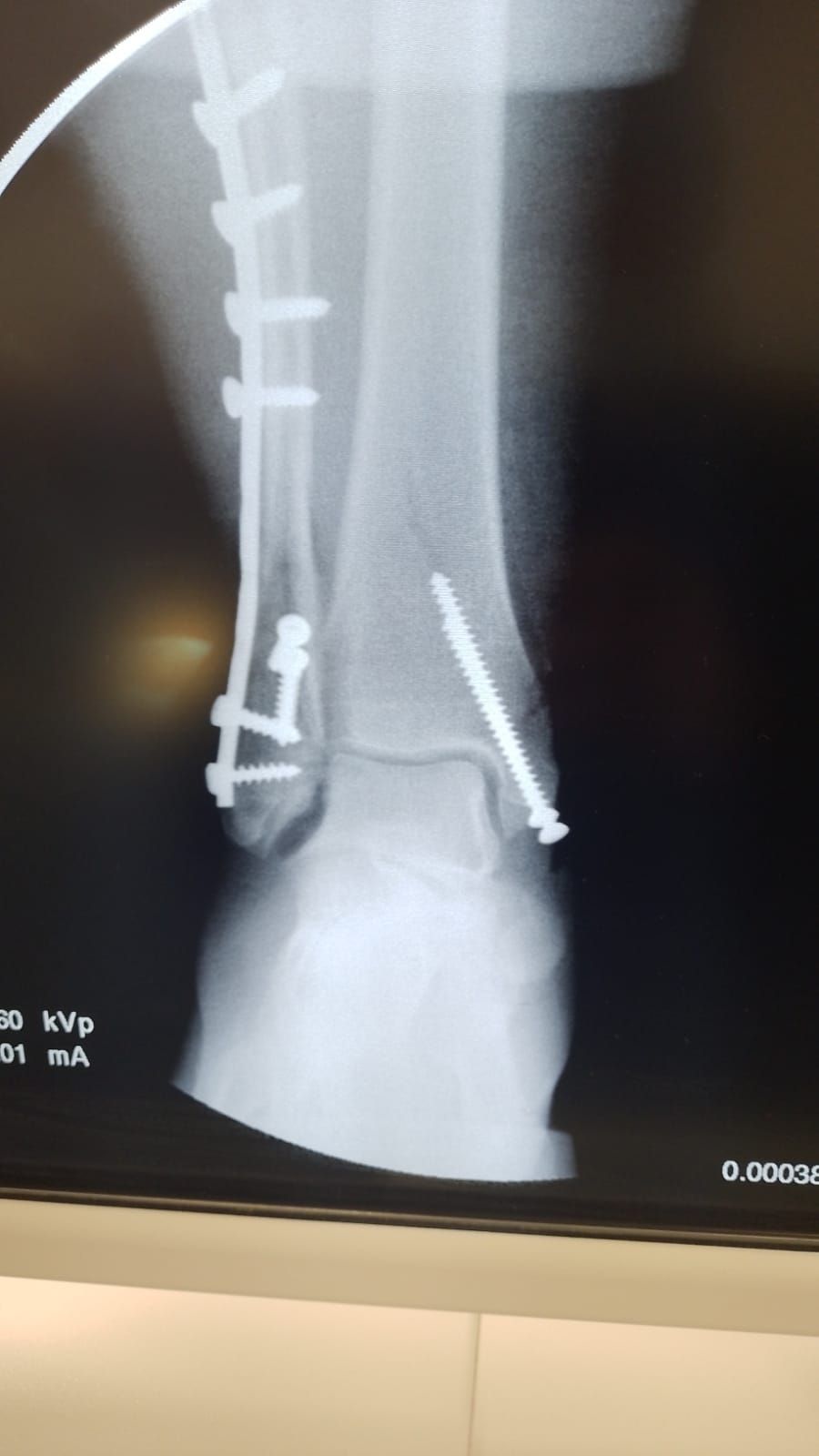 Juan Pablo Flores Pinzon-2