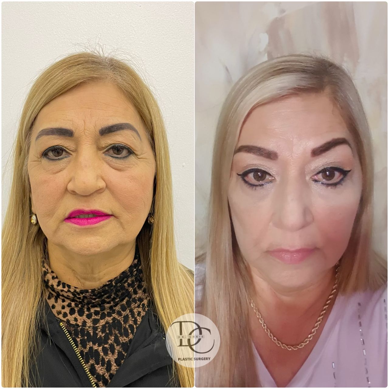 Christian Porras Mendez-7