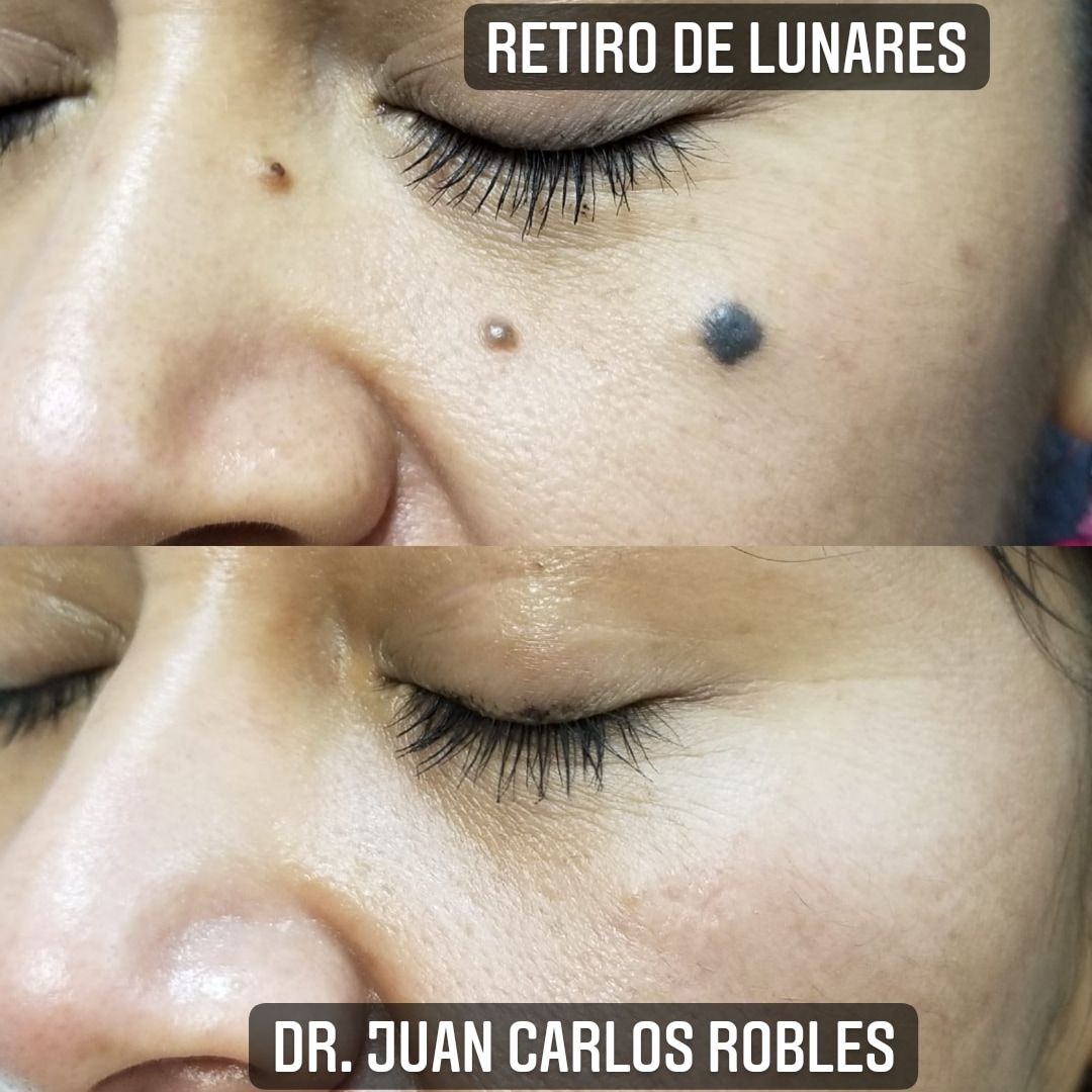 Juan Carlos Robles Méndez-11