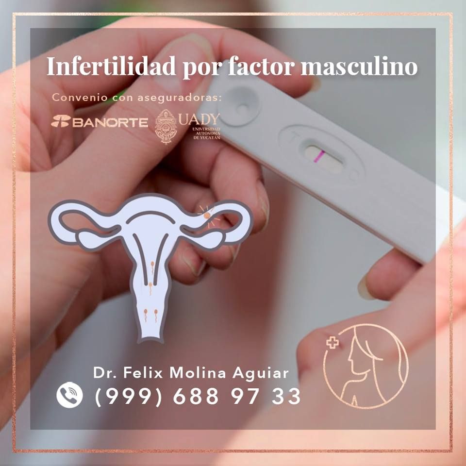 Félix José Molina Aguiar-25