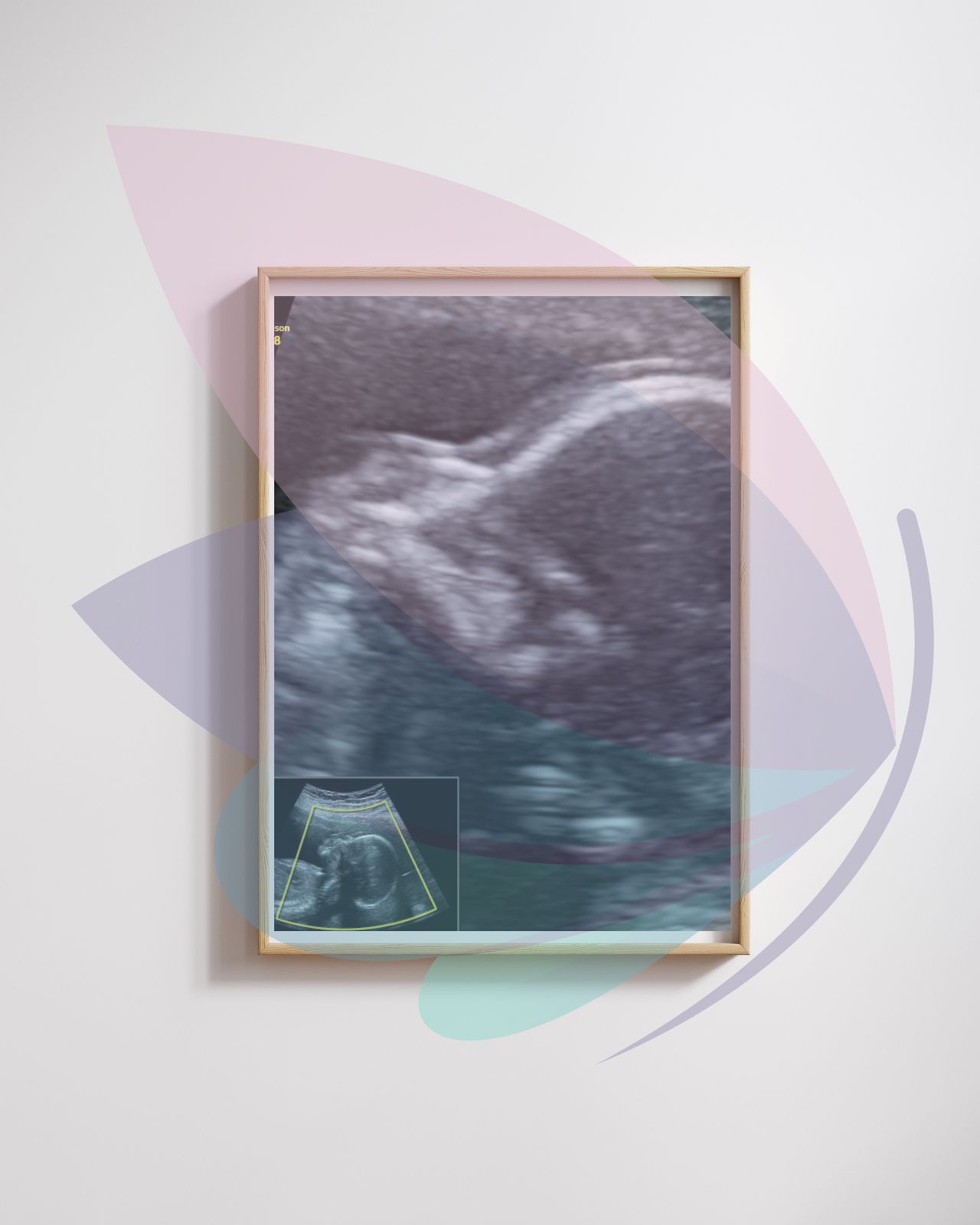 Edgar Zárate Xochimatzi-14