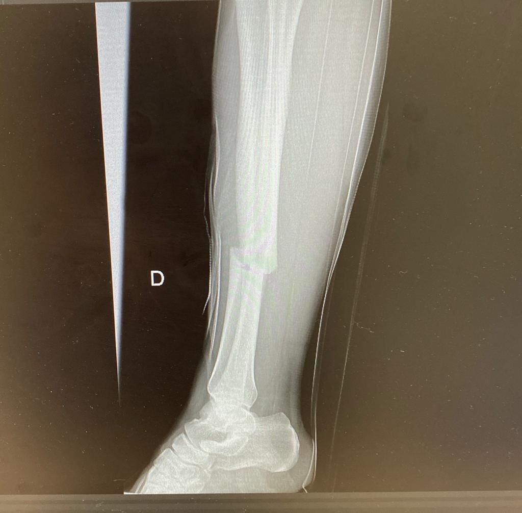 Jeftte Aaron Chacon Martinez-15