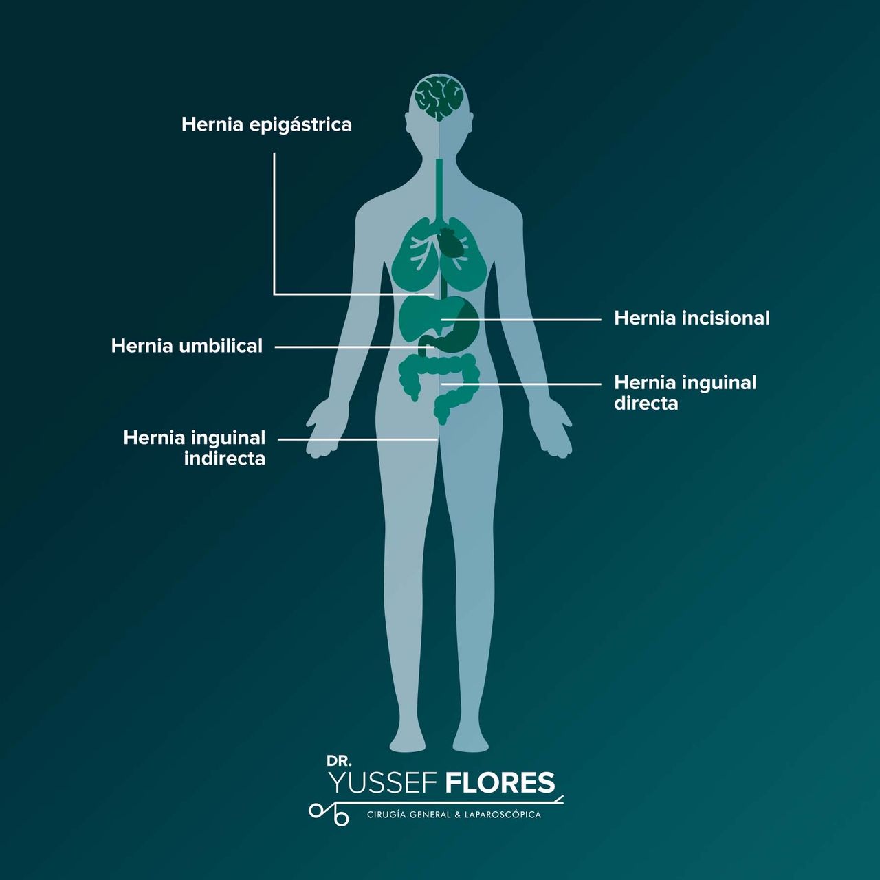 Yussef Flores López-37