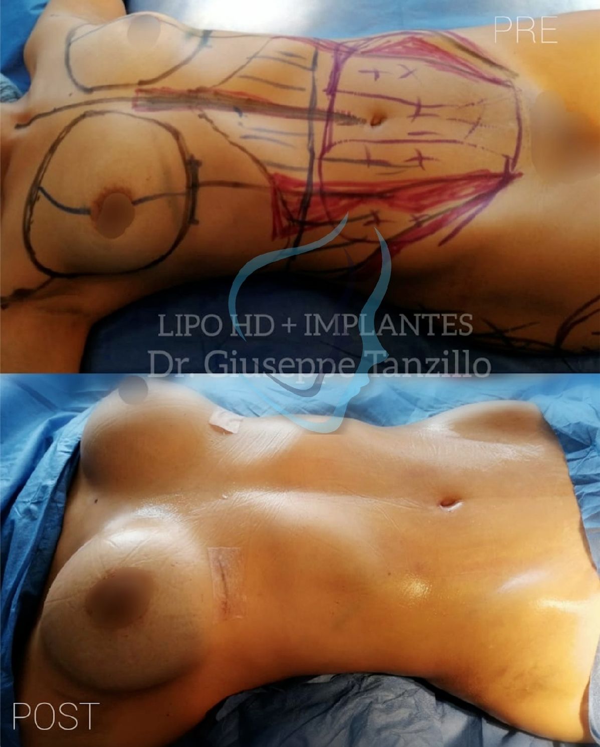 Giuseppe Tanzillo-42