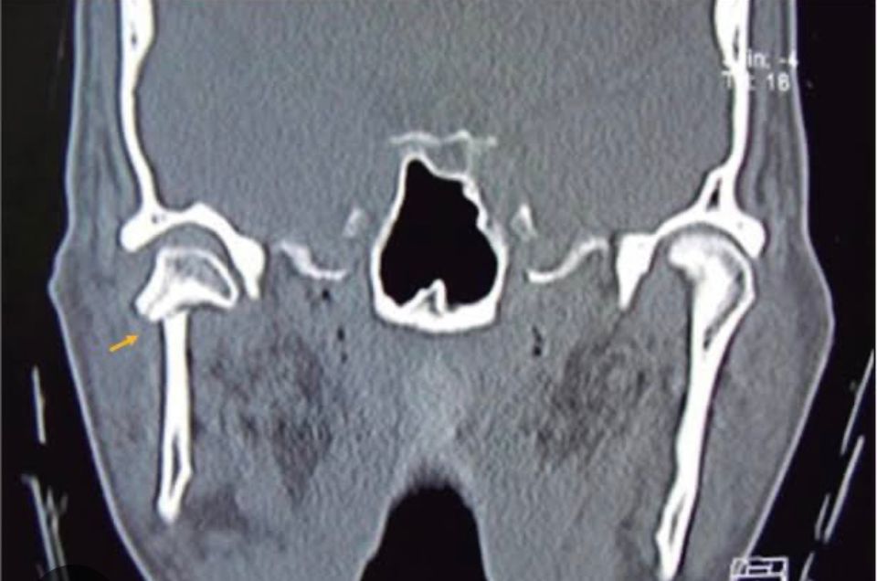 Erendalhi Rocha Mesta-12