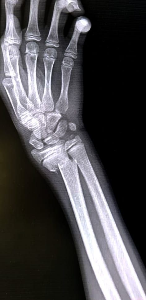 Luis Angel Moreno Espinoza-9